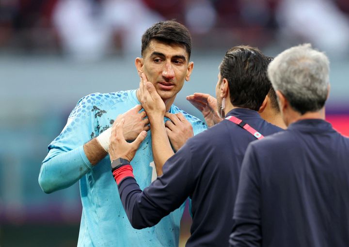 لحظة إصابة علي بيرانفاند حارس مرمى منتخب إيران الأساسي 
